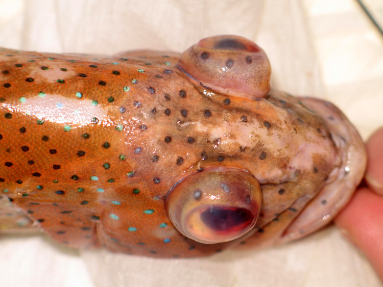 Exophtalmie - Yeux exorbités.